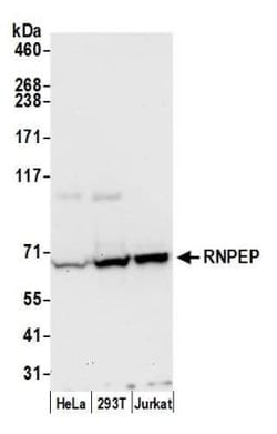Aminopeptidase B/RNPEP Rabbit anti-Human, Polyclonal, Novus Biologicals