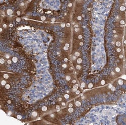 Aminopeptidase P1/XPNPEP1 Antibody, Novus Biologicals:Antikörper:Primärantikörper