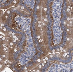 Aminopeptidase P1/XPNPEP1 Antibody, Novus Biologicals:Antibodies:Primary