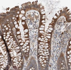 Aminopeptidase P1/XPNPEP1 Antibody, Novus Biologicals 0.1mL; Unlabeled:Antibodies,