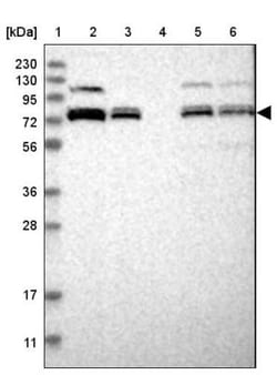 Aminopeptidase P1/XPNPEP1 Antibody, Novus Biologicals:Antibodies:Primary