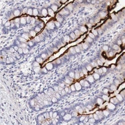 Aminopeptidase P2/XPNPEP2 Antibody, Novus Biologicals 25 &mu;L; Unlabeled:Antibodies,