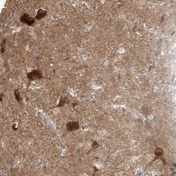 Amisyn Antibody, Novus Biologicals:Antibodies:Primary Antibodies