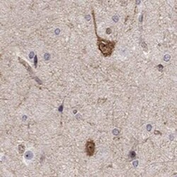 Amisyn Rabbit anti-Human, Polyclonal, Novus Biologicals:Antibodies:Primary