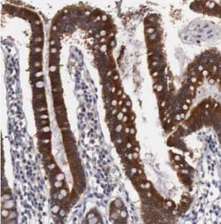 Amnionless/AMN Antibody, Novus Biologicals 25 &mu;L; Unlabeled:Antibodies,