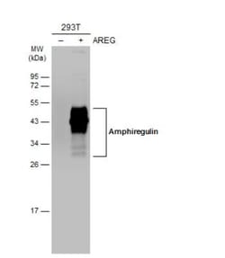 Amphiregulin Antibody, Novus Biologicals 0.1mL; Unlabeled:Antikroppar