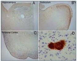 Amyloid Fibrils Antibody, Novus Biologicals 0.025 mL, Unconjugated:Antibodies,
