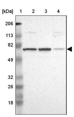 Angiomotin like 1 Antibody, Novus Biologicals 0.1mL; Unlabeled:Antibodies,