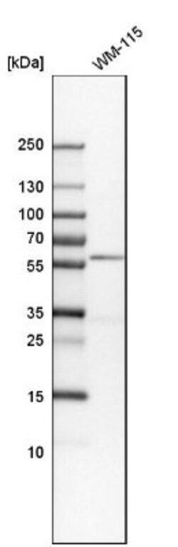 Angiopoietin-1 Antibody, Novus Biologicals:Antibodies:Primary Antibodies