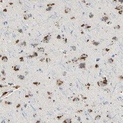 Angiopoietin-like Protein 1/ANGPTL1 Antibody, Novus Biologicals 0.1mL;