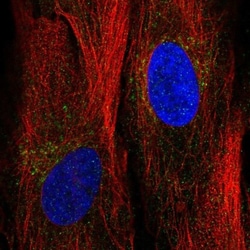 Angiopoietin-like Protein 2/ANGPTL2 Antibody, Novus Biologicals:Antibodies:Primary