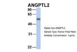 Angiopoietin-like Protein 2/ANGPTL2 Antibody, Novus Biologicals 0.05mg;