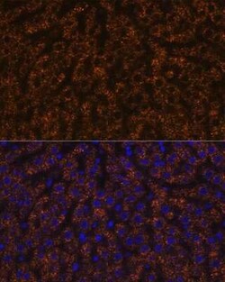 Angiopoietin-like Protein 3/ANGPTL3 Rabbit anti-Human, Mouse, Rat, Clone: 4W9A7, Novus Biologicals 20 &mu;g | Buy Online | Novus Biologicals | Fisher Scientific