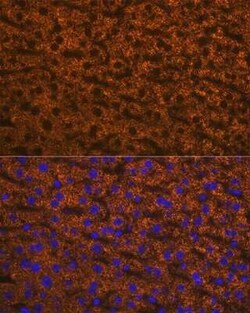 Angiopoietin-like Protein 3/ANGPTL3 Rabbit anti-Human, Mouse, Rat, Clone: 4W9A7, Novus Biologicals 20 &mu;g | Buy Online | Novus Biologicals | Fisher Scientific