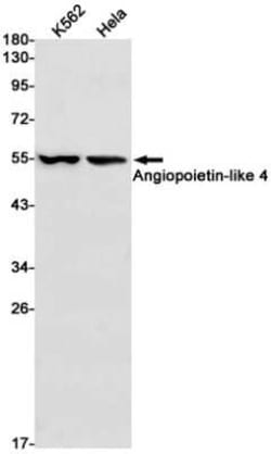 Angiopoietin-like Protein 4/ANGPTL4 Rabbit anti-Human, Clone: S04-1B5,