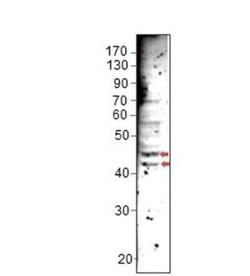 Angiopoietin-like Protein 5/ANGPTL5 Antibody, Novus Biologicals 100 &mu;g | Buy Online | Novus Biologicals | Fisher Scientific