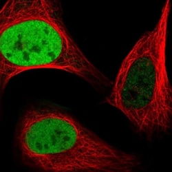 Anillin Antibody, Novus Biologicals 0.1mL; Unlabeled:Antibodies, Polyclonal