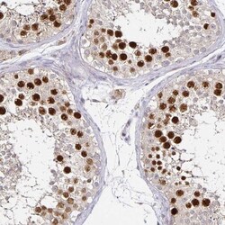 Anillin Antibody, Novus Biologicals:Antibodies:Primary Antibodies