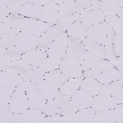 Anillin Antibody, Novus Biologicals 0.1mL; Unlabeled:Antibodies, Polyclonal