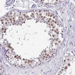 Anillin Antibody, Novus Biologicals 0.1mL; Unlabeled:Antibodies, Polyclonal