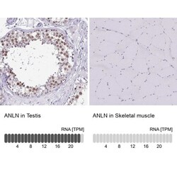 Anillin Antibody, Novus Biologicals 0.1mL; Unlabeled:Antibodies, Polyclonal