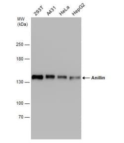Anillin Antibody, Novus Biologicals 0.1mg; Unlabeled:Antibodies, Polyclonal