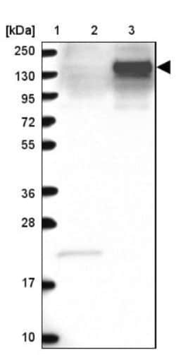 Anillin Antibody, Novus Biologicals 0.1mL; Unlabeled:Antibodies, Polyclonal