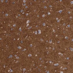 Ankyrin Brain Antibody, Novus Biologicals 0.1mL; Unlabeled:Antibodies,