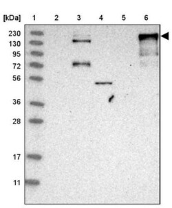 Ankyrin Brain Antibody, Novus Biologicals 0.1mL; Unlabeled:Antibodies,