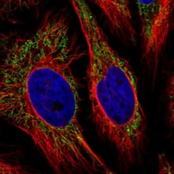 Ankyrin Repeat Domain 33B Antibody, Novus Biologicals 25 &mu;L, Unlabeled:Antibodies,