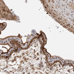 Annexin A11 Antibody, Novus Biologicals 0.1mL; Unlabeled:Antikroppar