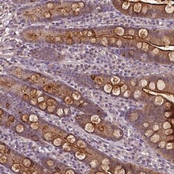 Annexin A13 Antibody, Novus Biologicals 0.1mL; Unlabeled:Antibodies, Polyclonal