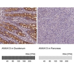 Annexin A13 Antibody, Novus Biologicals 0.1mL; Unlabeled:Antibodies, Polyclonal