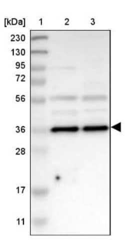 Annexin A13 Antibody, Novus Biologicals 0.1mL; Unlabeled:Antibodies, Polyclonal