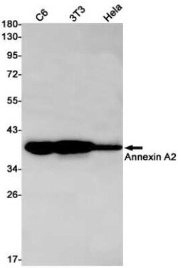 Annexin A2 Rabbit anti-Human, Mouse, Rat, Clone: S09-5C1, Novus Biologicals 25 &mu;g | Buy Online | Novus Biologicals | Fisher Scientific