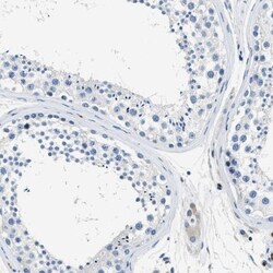 Annexin A3 Antibody, Novus Biologicals:Antibodies:Primary Antibodies