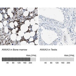 Annexin A3 Antibody, Novus Biologicals:Antibodies:Primary Antibodies