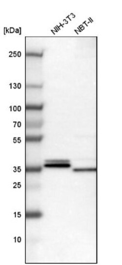 Annexin A3 Antibody, Novus Biologicals:Antibodies:Primary Antibodies