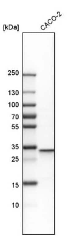 Annexin A3 Antibody, Novus Biologicals:Antibodies:Primary Antibodies
