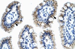 Annexin A4 Antibody, Novus Biologicals 0.1mg; Unlabeled:Antibodies, Polyclonal
