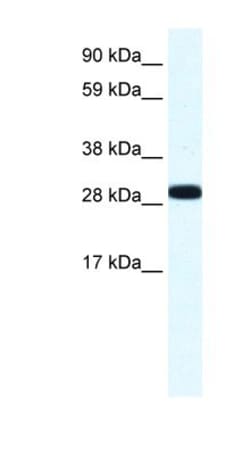 Annexin A4 Antibody, Novus Biologicals 0.1mg; Unlabeled:Antibodies, Polyclonal
