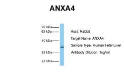 Annexin A4 Antibody, Novus Biologicals 0.1mg; Unlabeled:Antibodies, Polyclonal