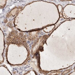Annexin A9 Antibody, Novus Biologicals:Antibodies:Primary Antibodies