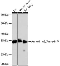Annexin V Rabbit anti-Human, Mouse, Rat, Clone: 9A5M8, Novus Biologicals:Antibodies:Primary