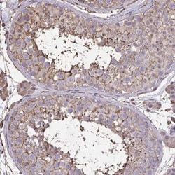 Annexin V Antibody, Novus Biologicals 0.1mL; Unlabeled:Antibodies, Polyclonal