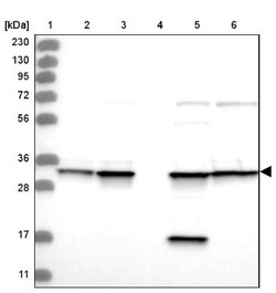 Annexin V Antibody, Novus Biologicals 0.1mL; Unlabeled:Antibodies, Polyclonal