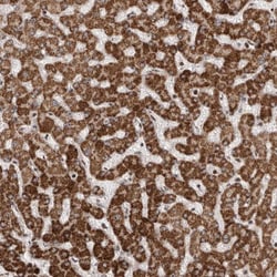 Antizyme inhibitor 1 Antibody, Novus Biologicals:Antibodies:Primary Antibodies