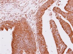 Apc10 Antibody, Novus Biologicals 0.1mL; Unlabeled:Antibodies, Polyclonal