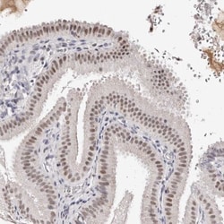 Apc11 Antibody, Novus Biologicals:Antibodies:Primary Antibodies