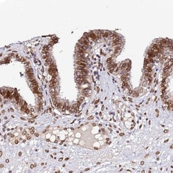 Apc5 Antibody, Novus Biologicals:Antibodies:Primary Antibodies